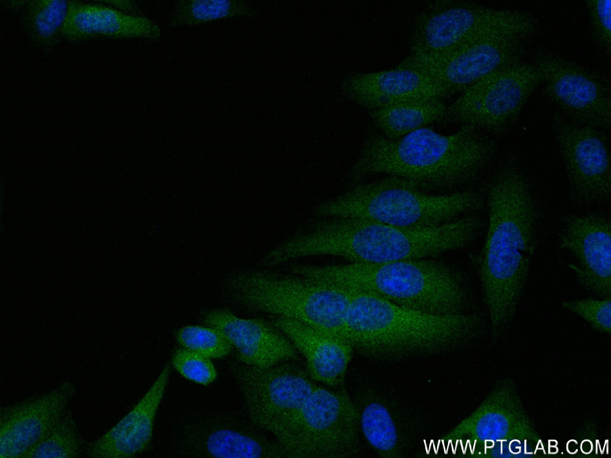 IF Staining of HepG2 using 83341-2-RR (same clone as 83341-2-PBS)