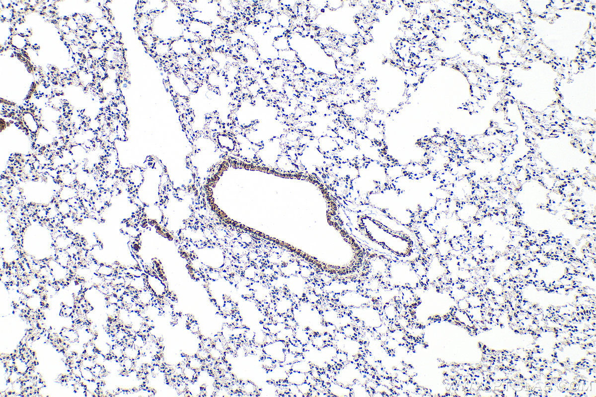 IHC staining of mouse lung using 83341-2-RR