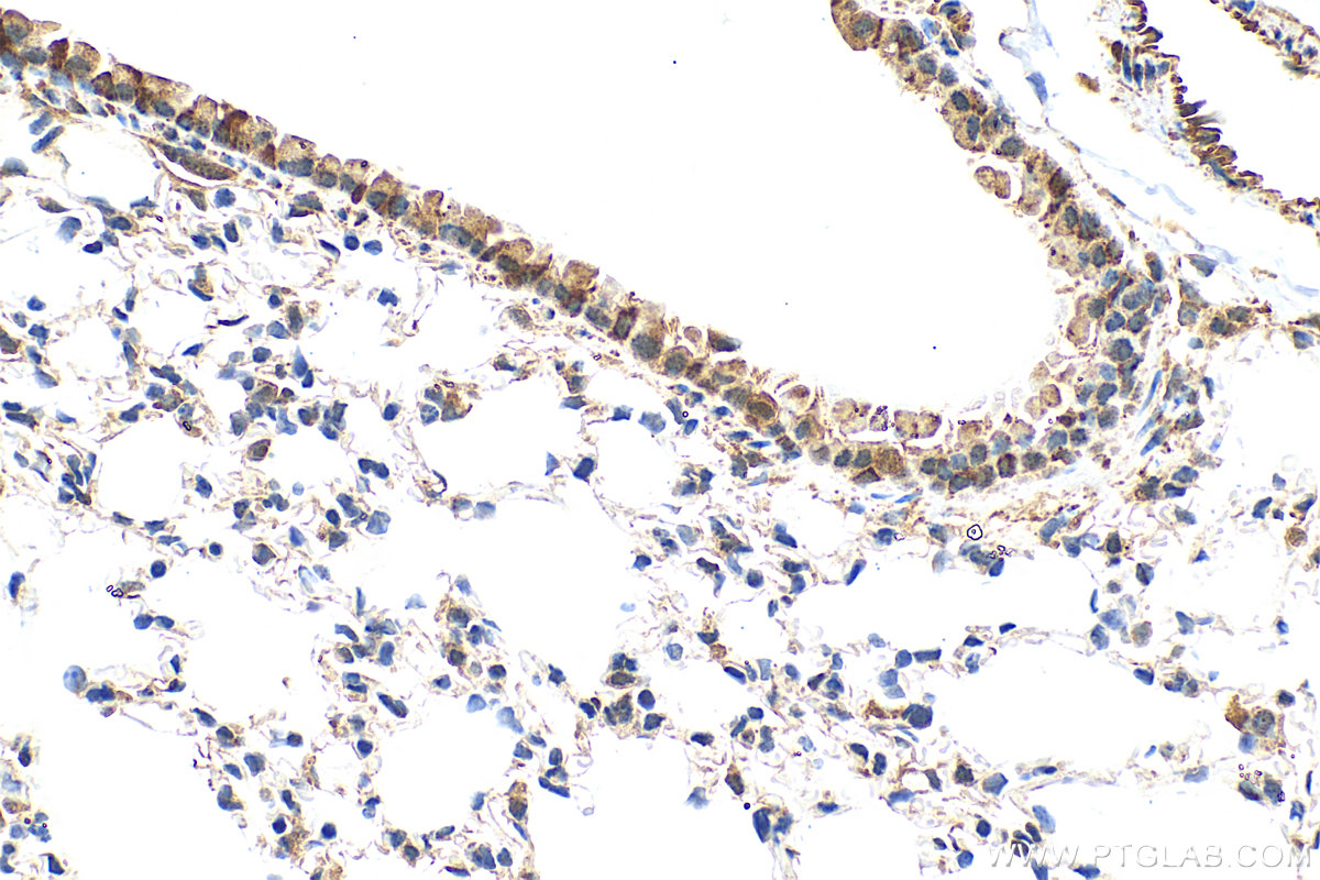 IHC staining of mouse lung using 83341-2-RR