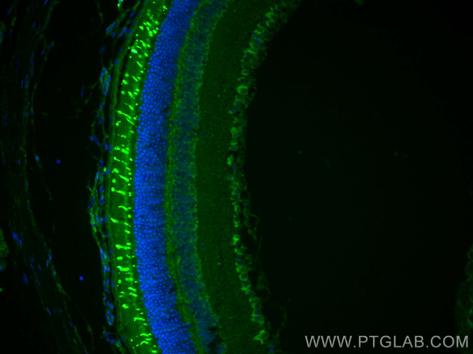 IF Staining of mouse eye using 24660-1-AP