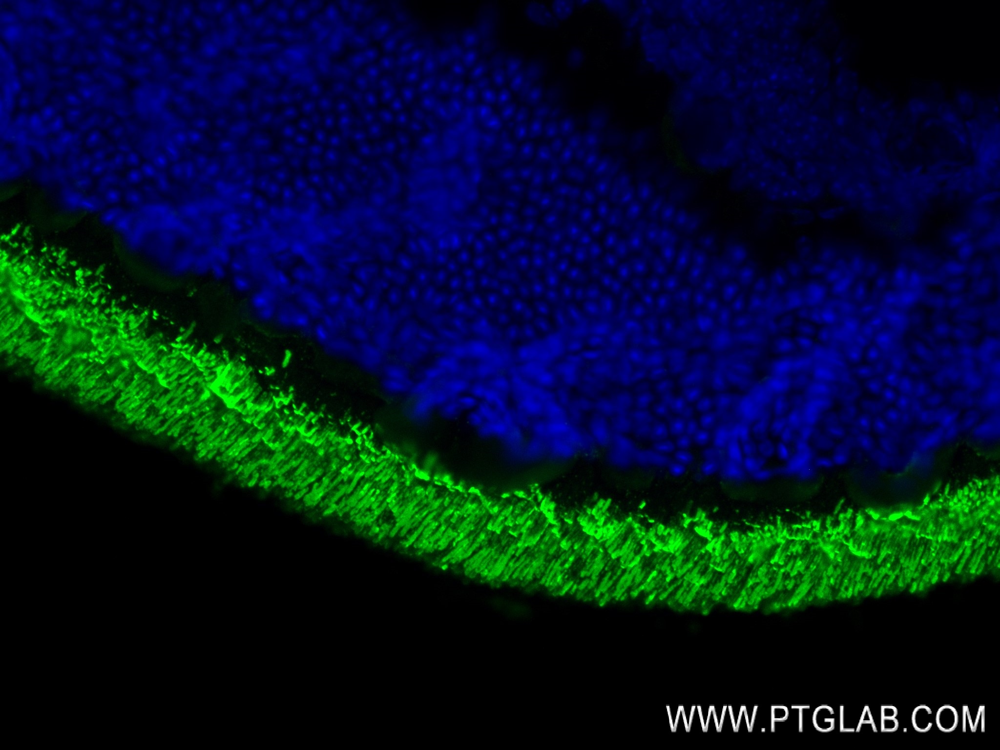 IF Staining of mouse eye using 83754-6-RR (same clone as 83754-6-PBS)