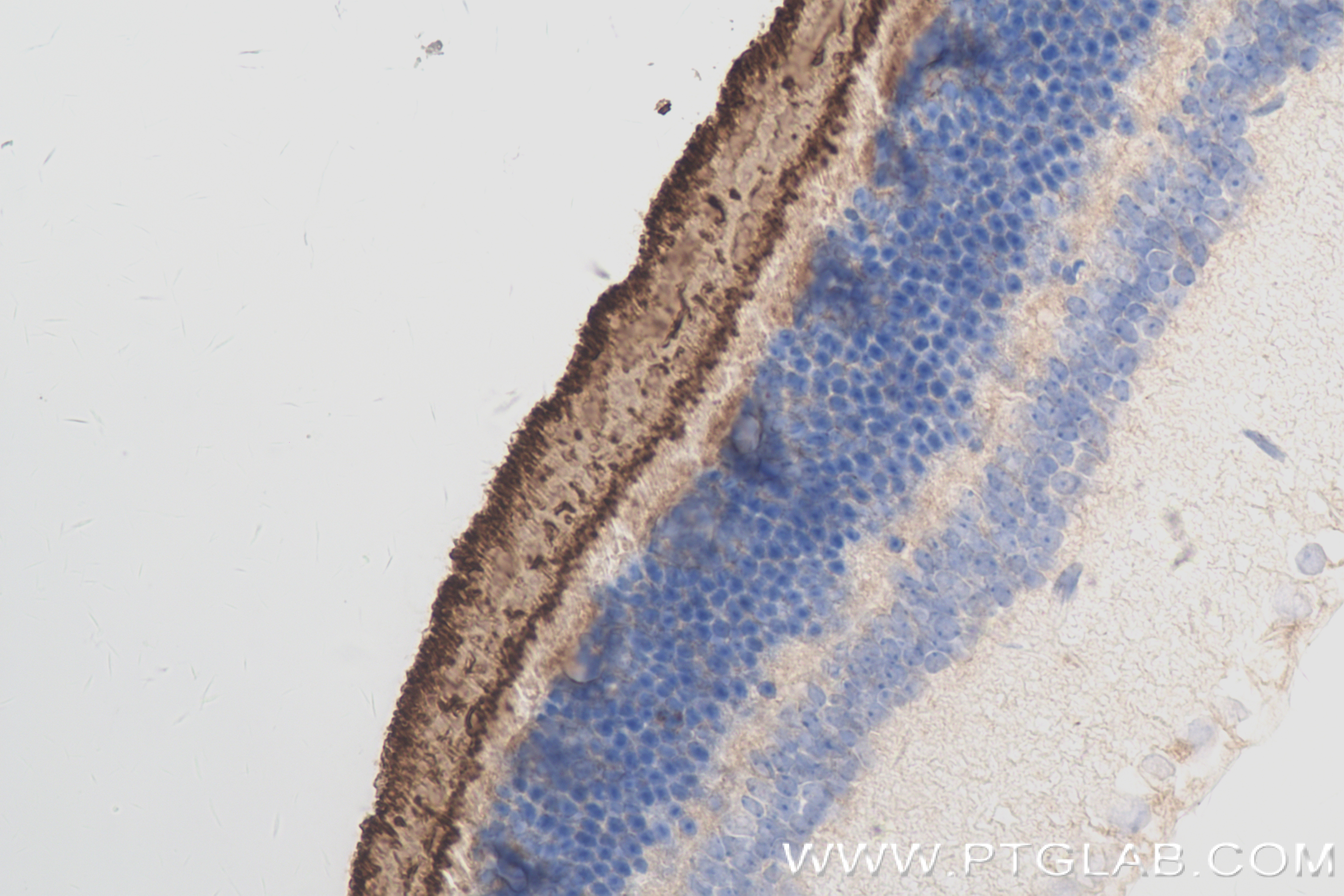 IHC staining of mouse eye using 83754-6-RR (same clone as 83754-6-PBS)