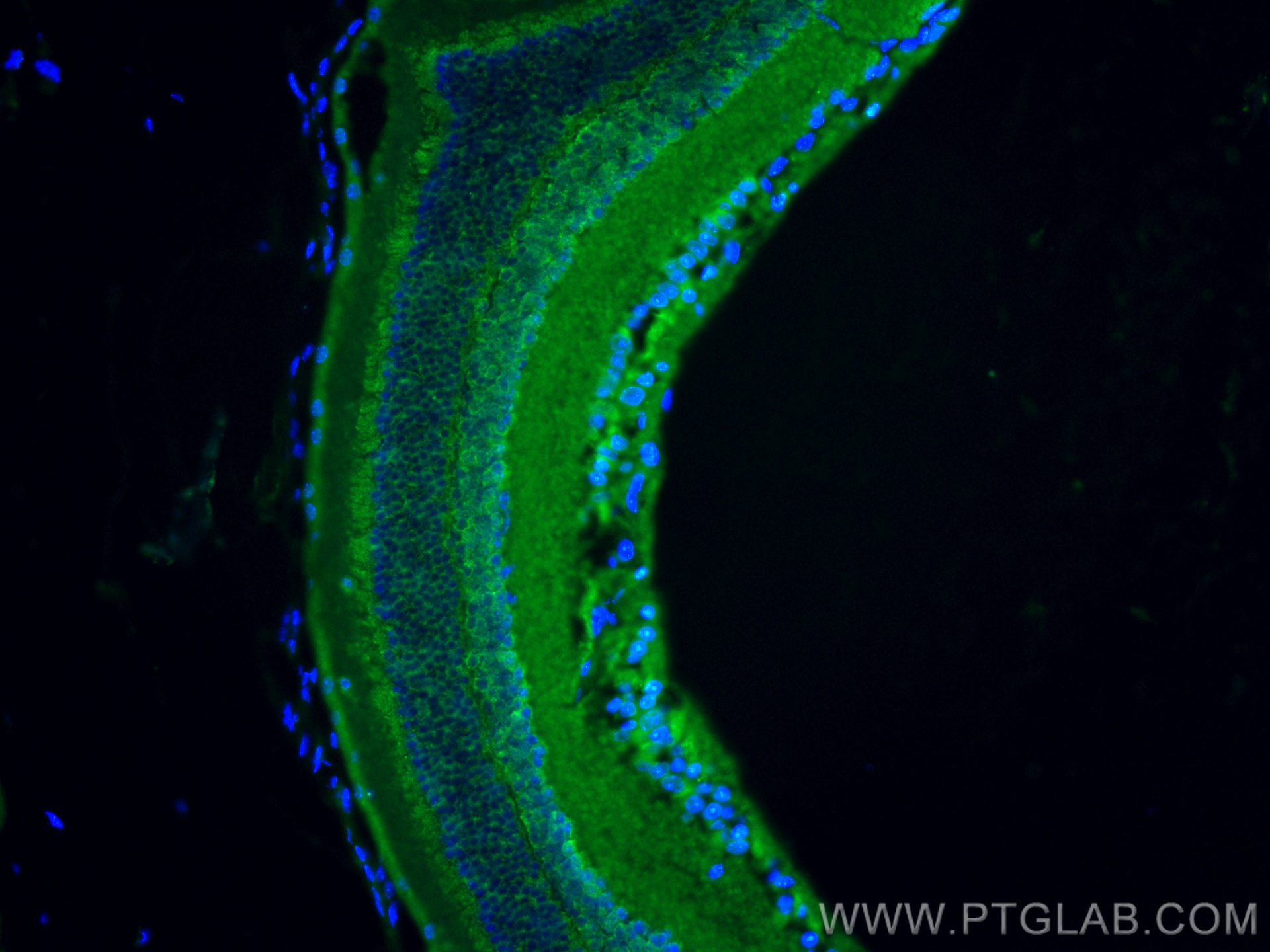 IF Staining of mouse eye using 24478-1-AP