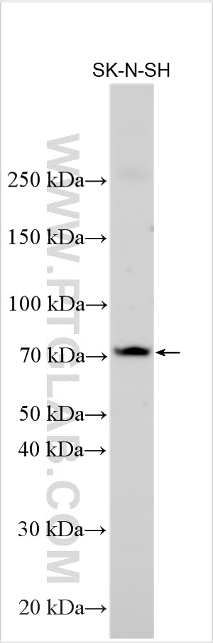 OPRM1