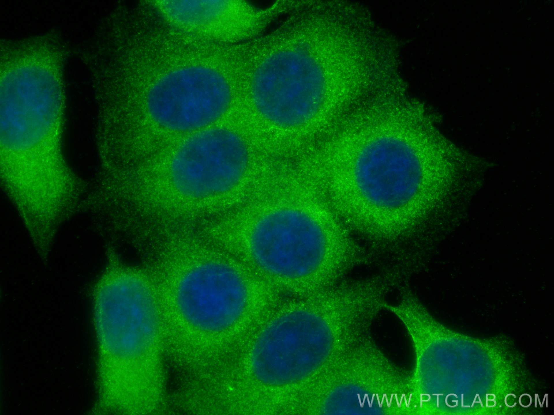 IF Staining of MCF-7 using 10837-1-AP