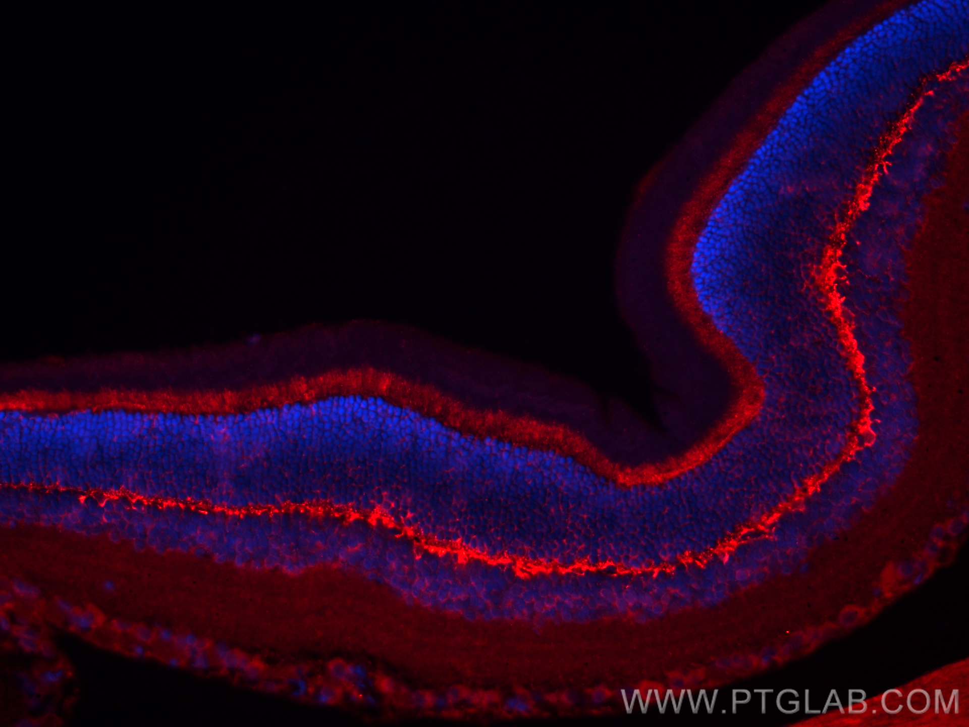 IF Staining of rat eye using 10837-1-AP