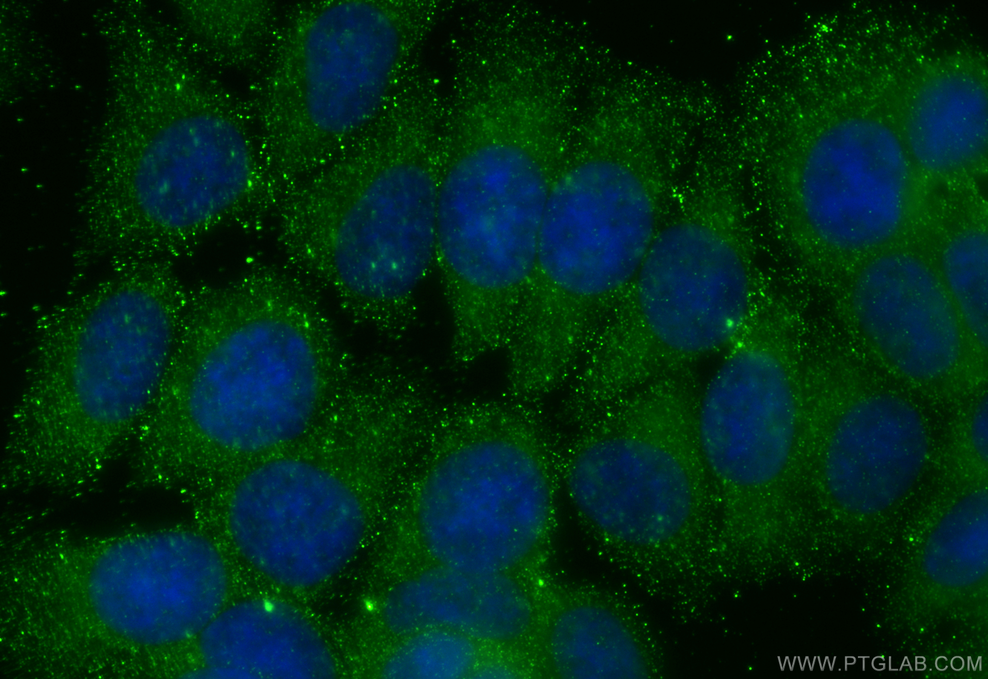 IF Staining of MCF-7 using 60293-1-Ig