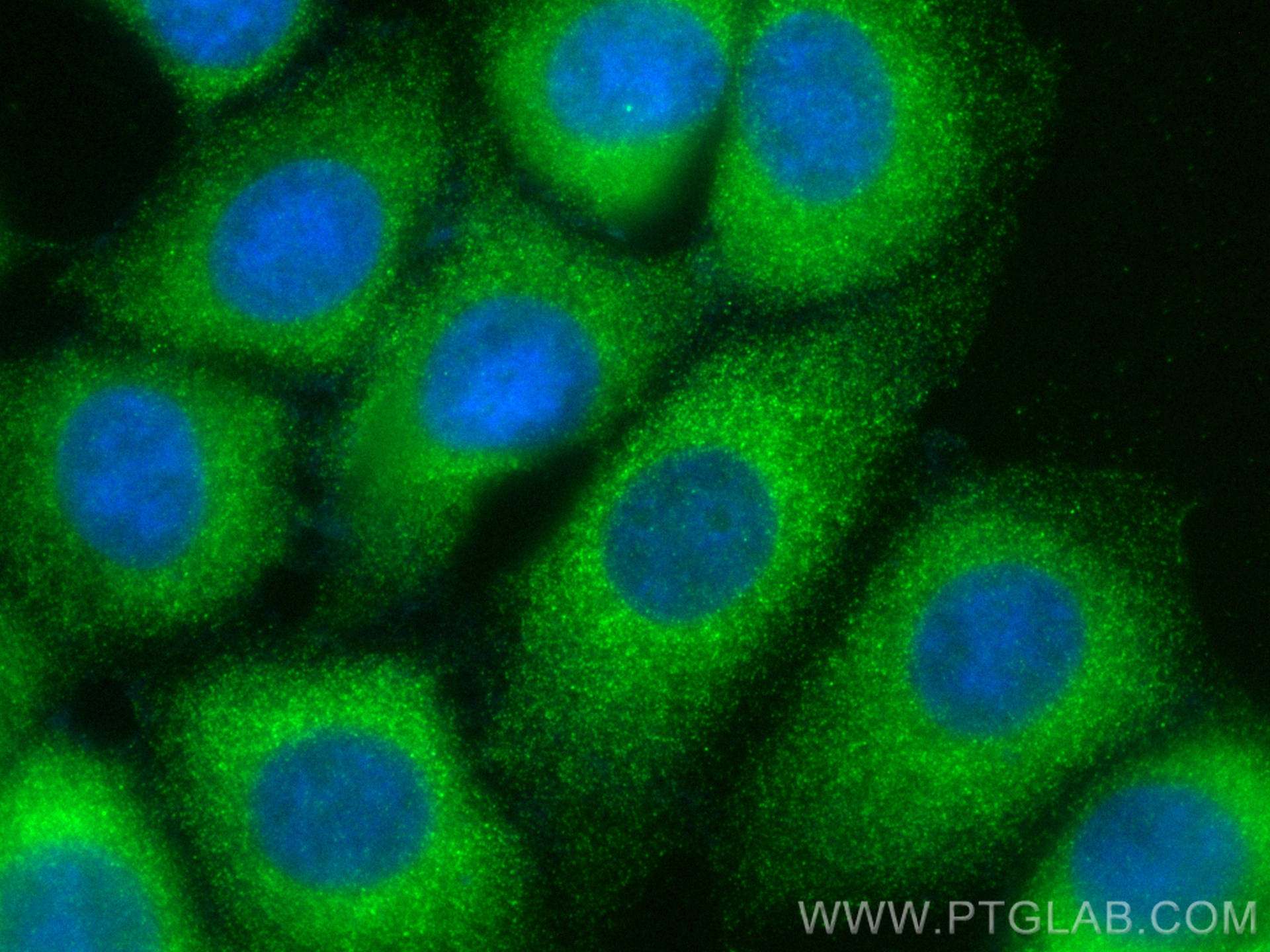 IF Staining of MCF-7 using CL488-10837