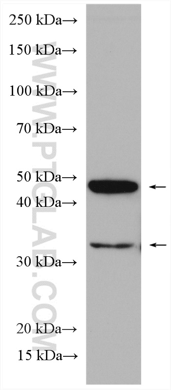 ORAI1