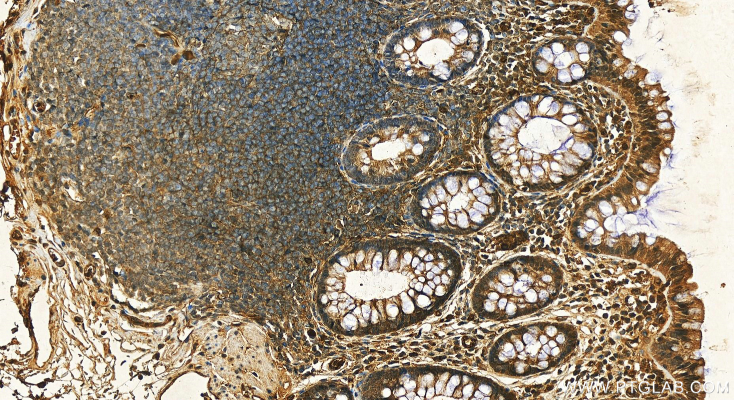 IHC staining of human normal colon using 16439-1-AP