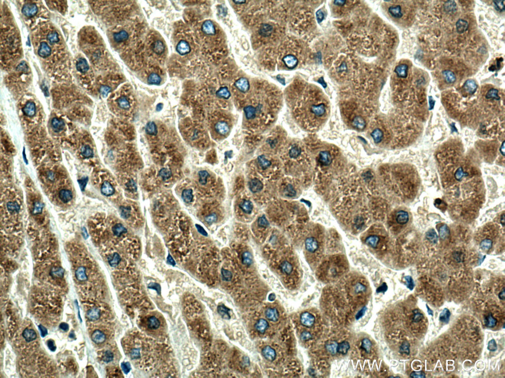 IHC staining of human liver using 16439-1-AP