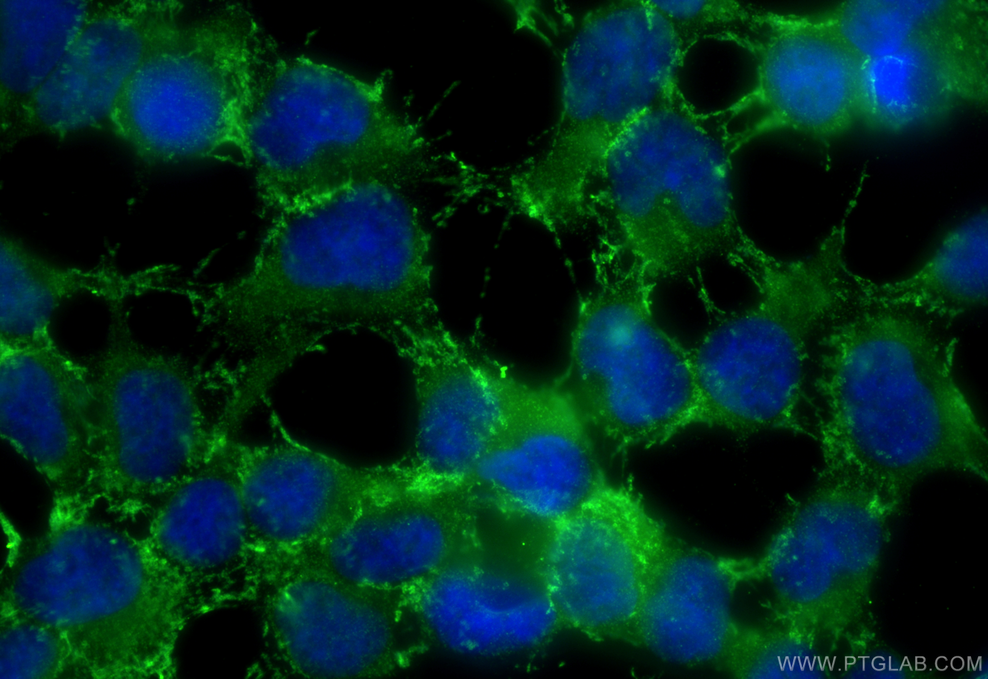 IF Staining of HEK-293 using 11199-1-AP (same clone as 11199-1-PBS)