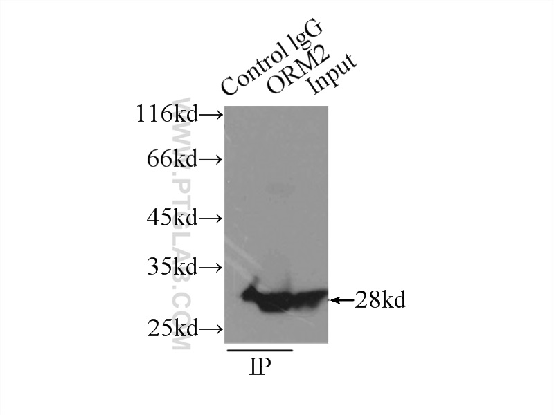 IP experiment of L02 using 11199-1-AP