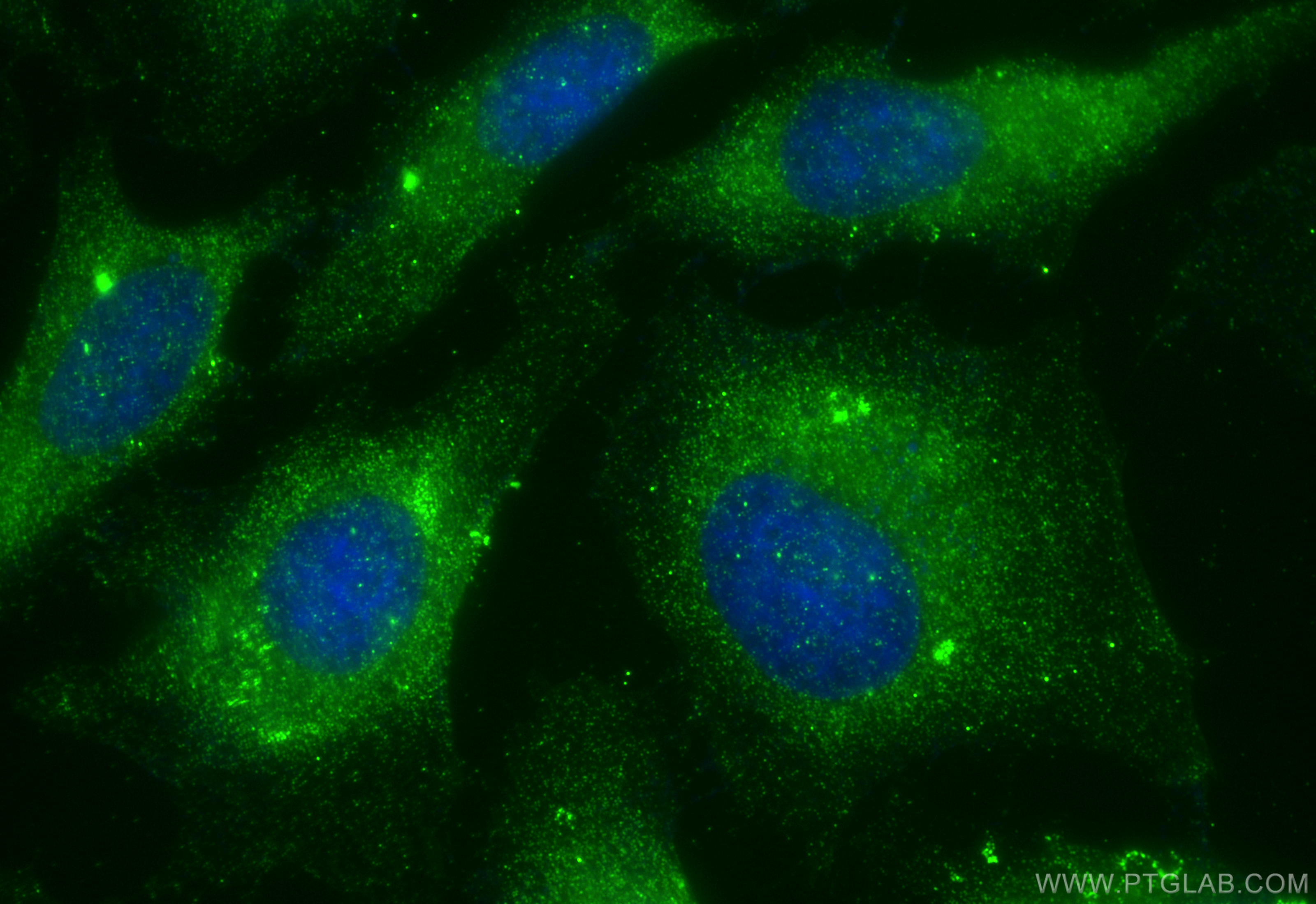 IF Staining of HeLa using 10061-1-AP