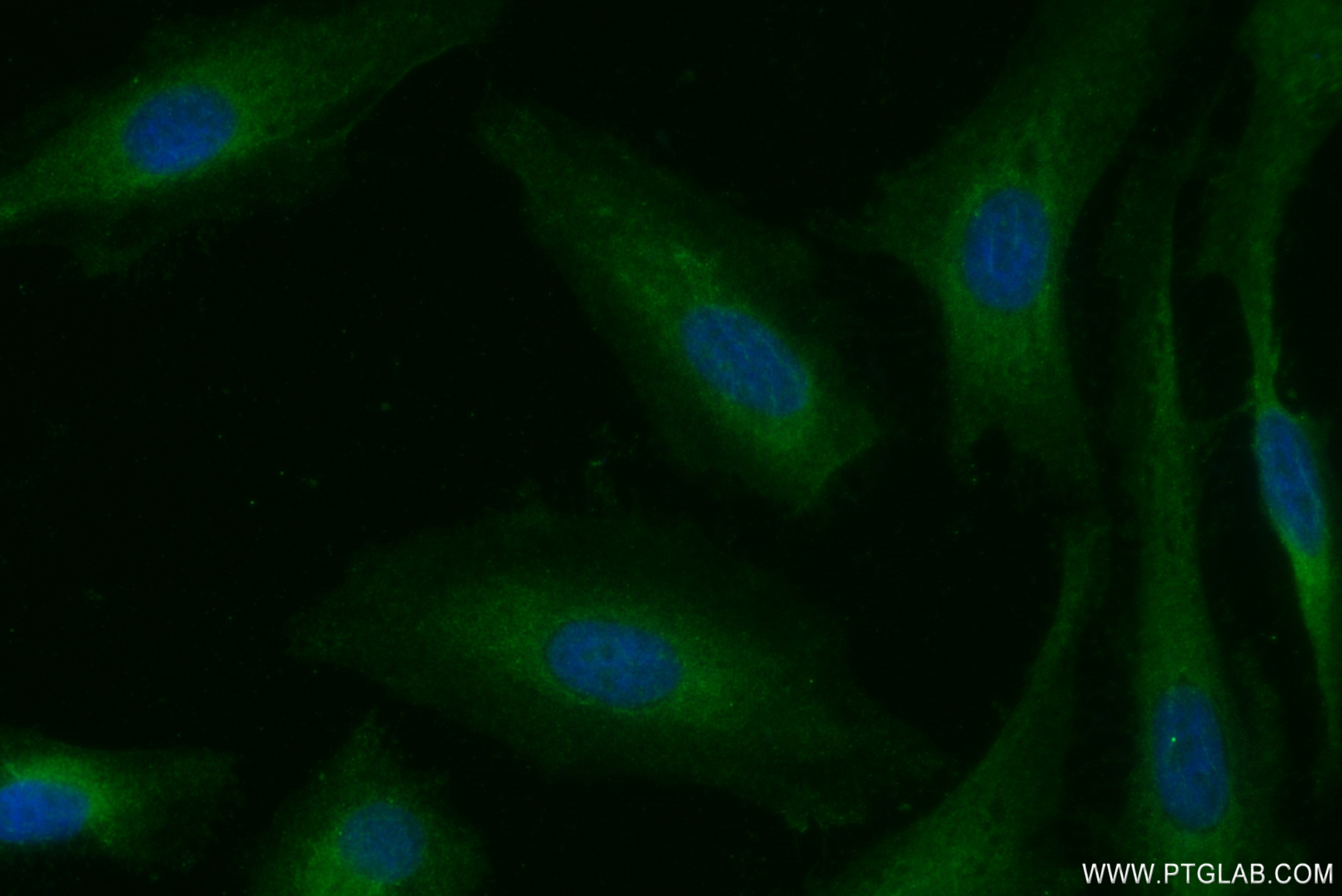 IF Staining of HeLa using 82932-2-RR (same clone as 82932-2-PBS)