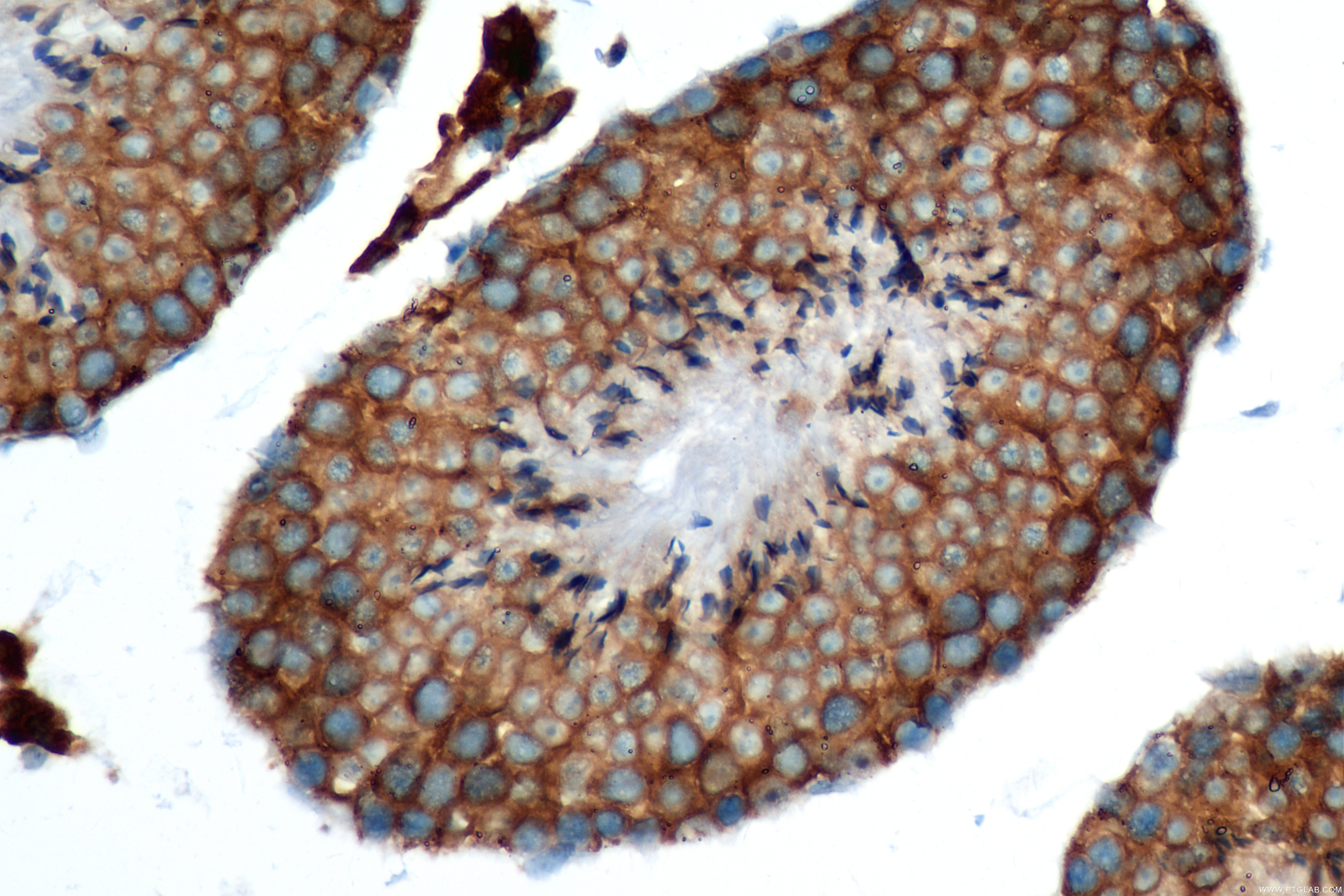 IHC staining of mouse testis using 82932-2-RR (same clone as 82932-2-PBS)