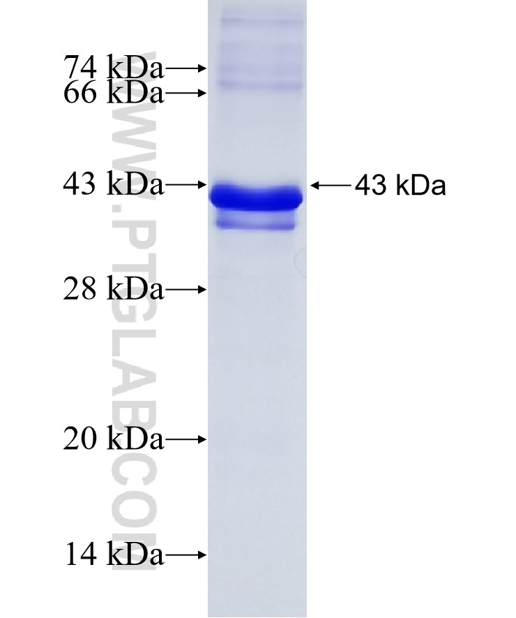 OSBP fusion protein Ag22636 SDS-PAGE