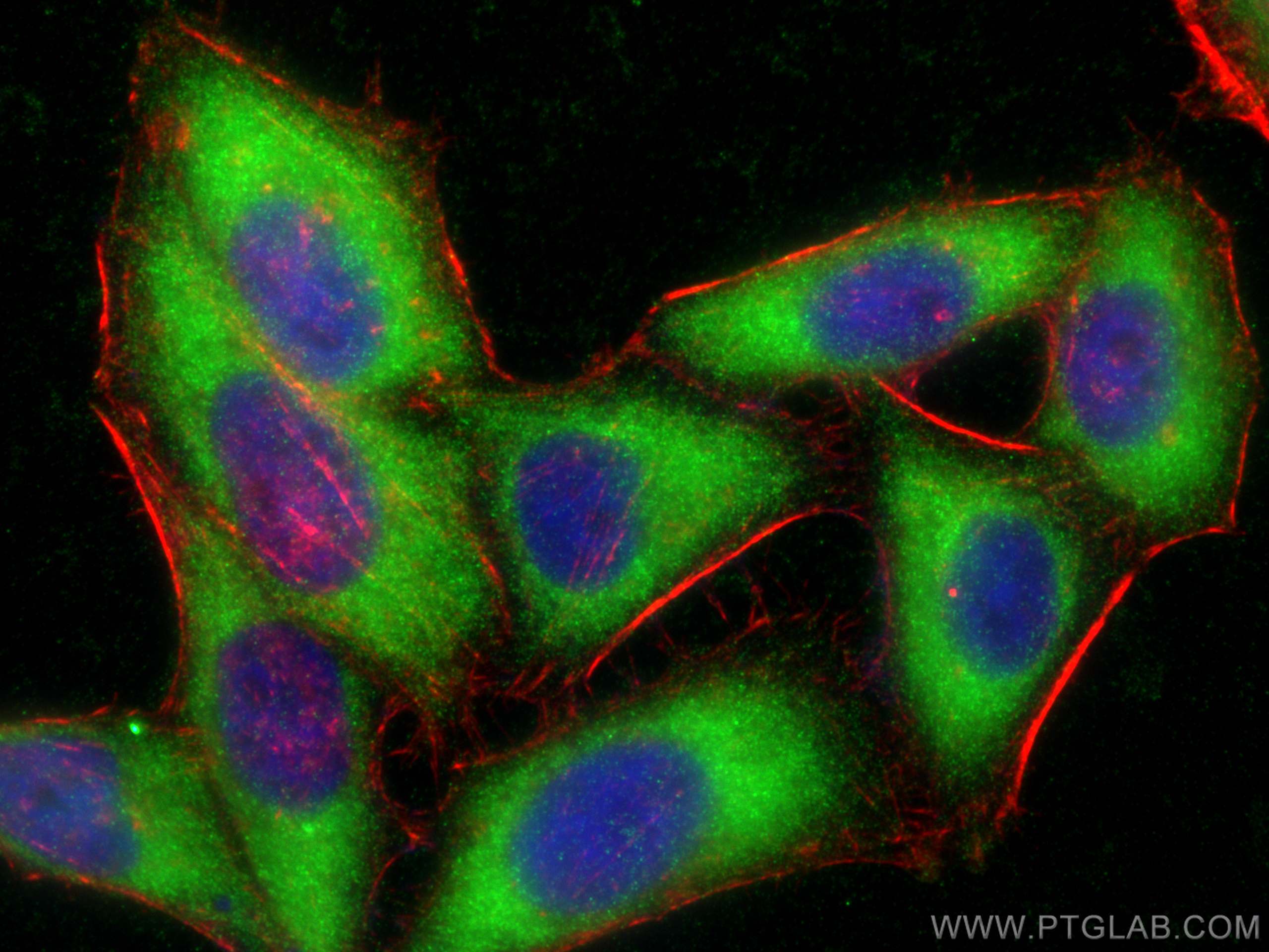 IF Staining of HepG2 using 15491-1-AP