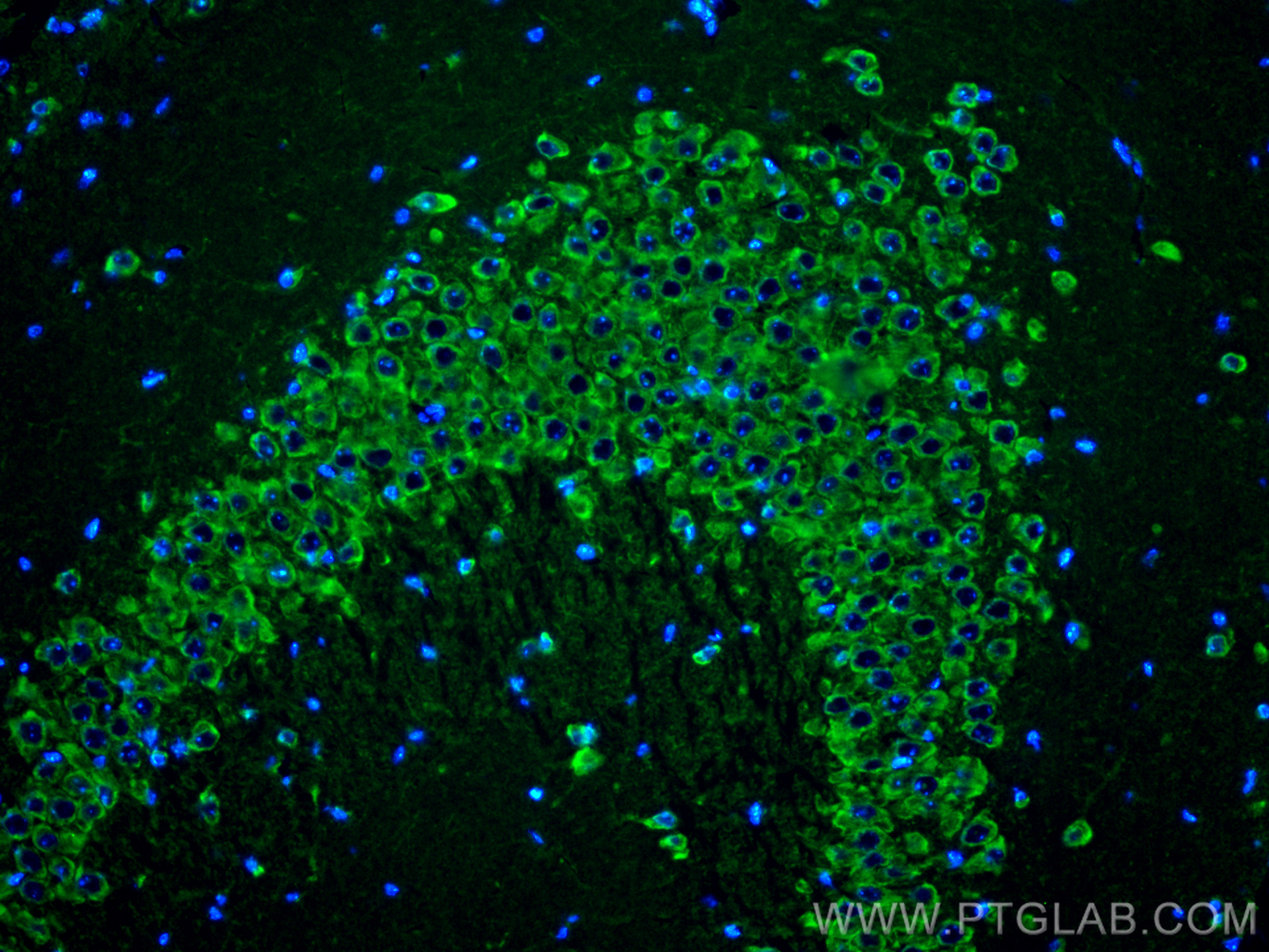 IF Staining of mouse brain using 14751-1-AP