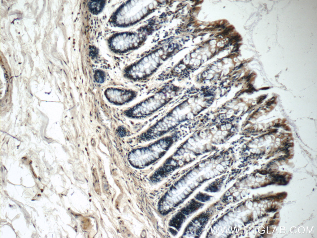 IHC staining of human colon using 25694-1-AP