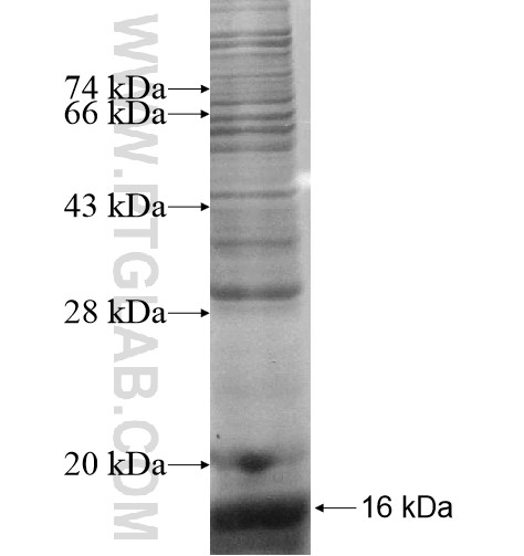 OSR2 fusion protein Ag14276 SDS-PAGE