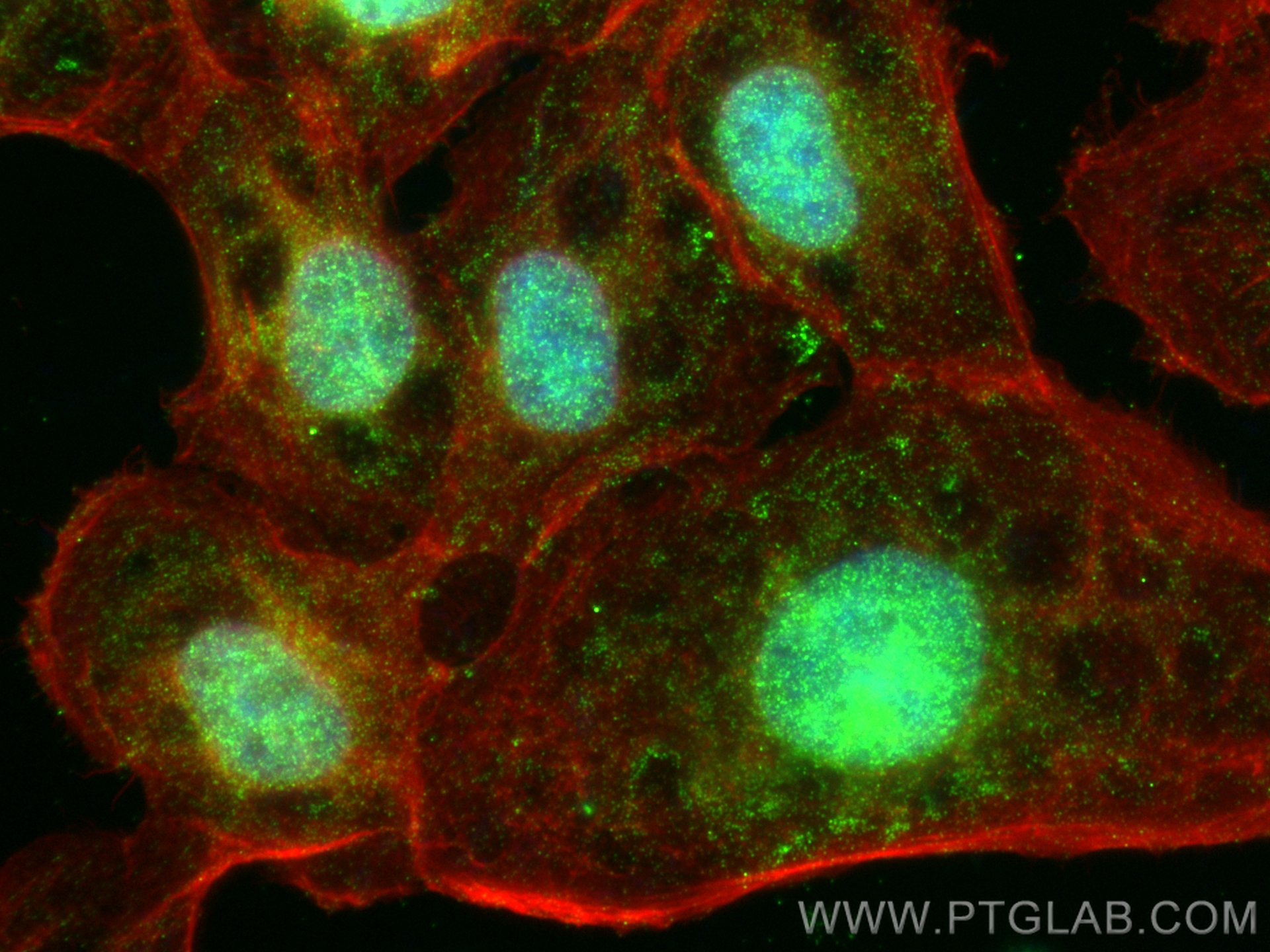 IF Staining of A431 using 14621-1-AP