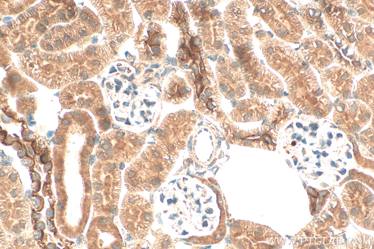 IHC staining of mouse kidney using 14621-1-AP