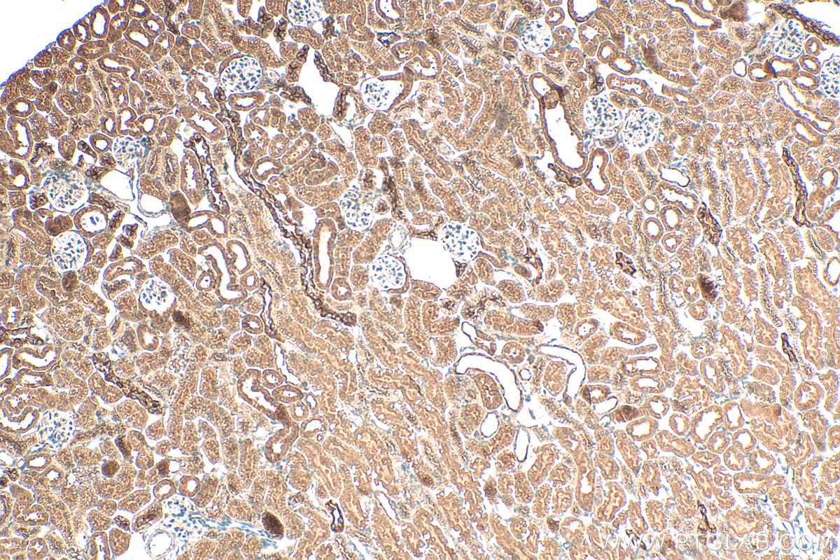 IHC staining of mouse kidney using 14621-1-AP