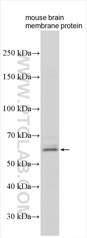 WB analysis using 14621-1-AP