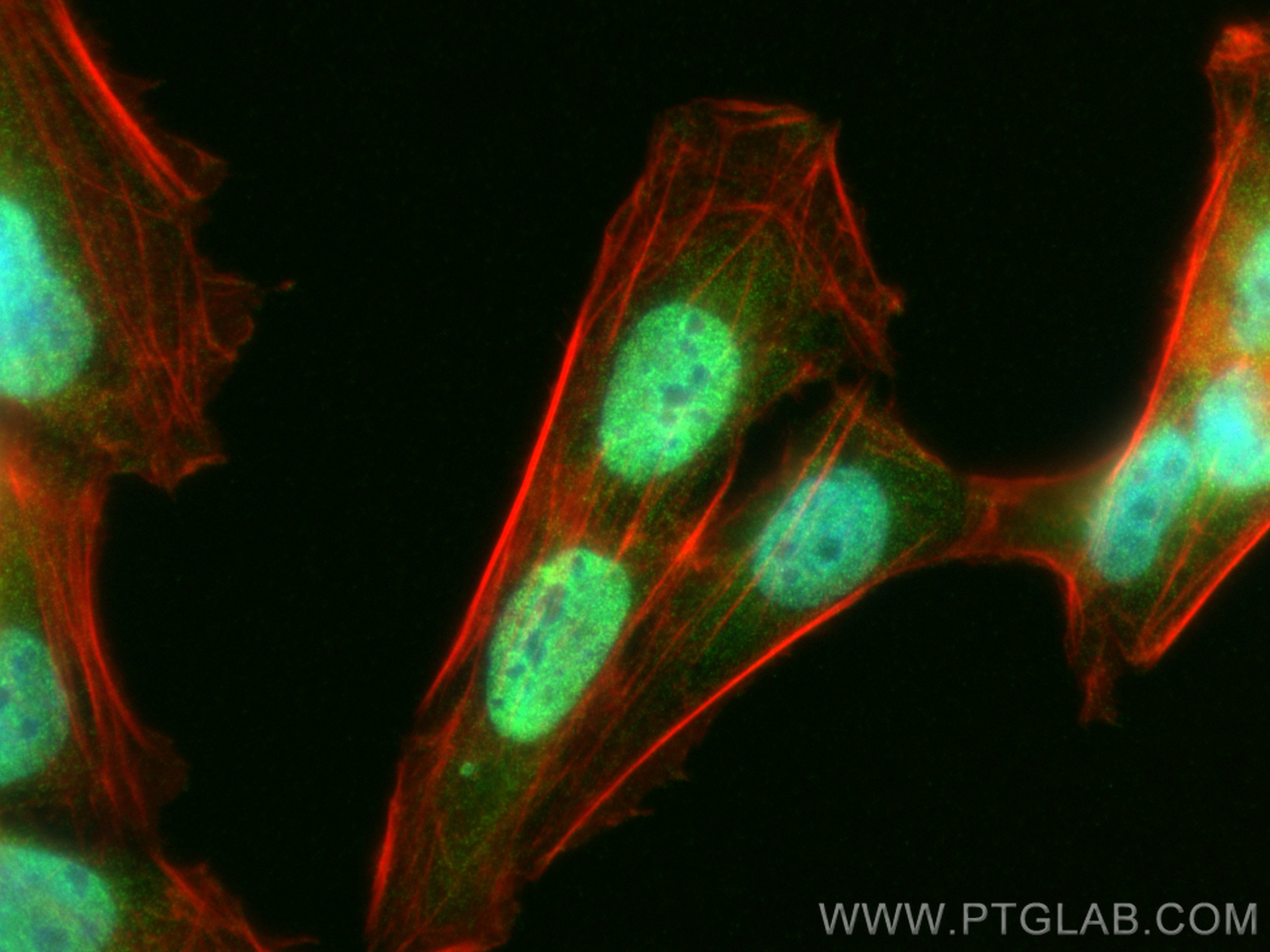 IF Staining of U2OS using 12066-1-AP