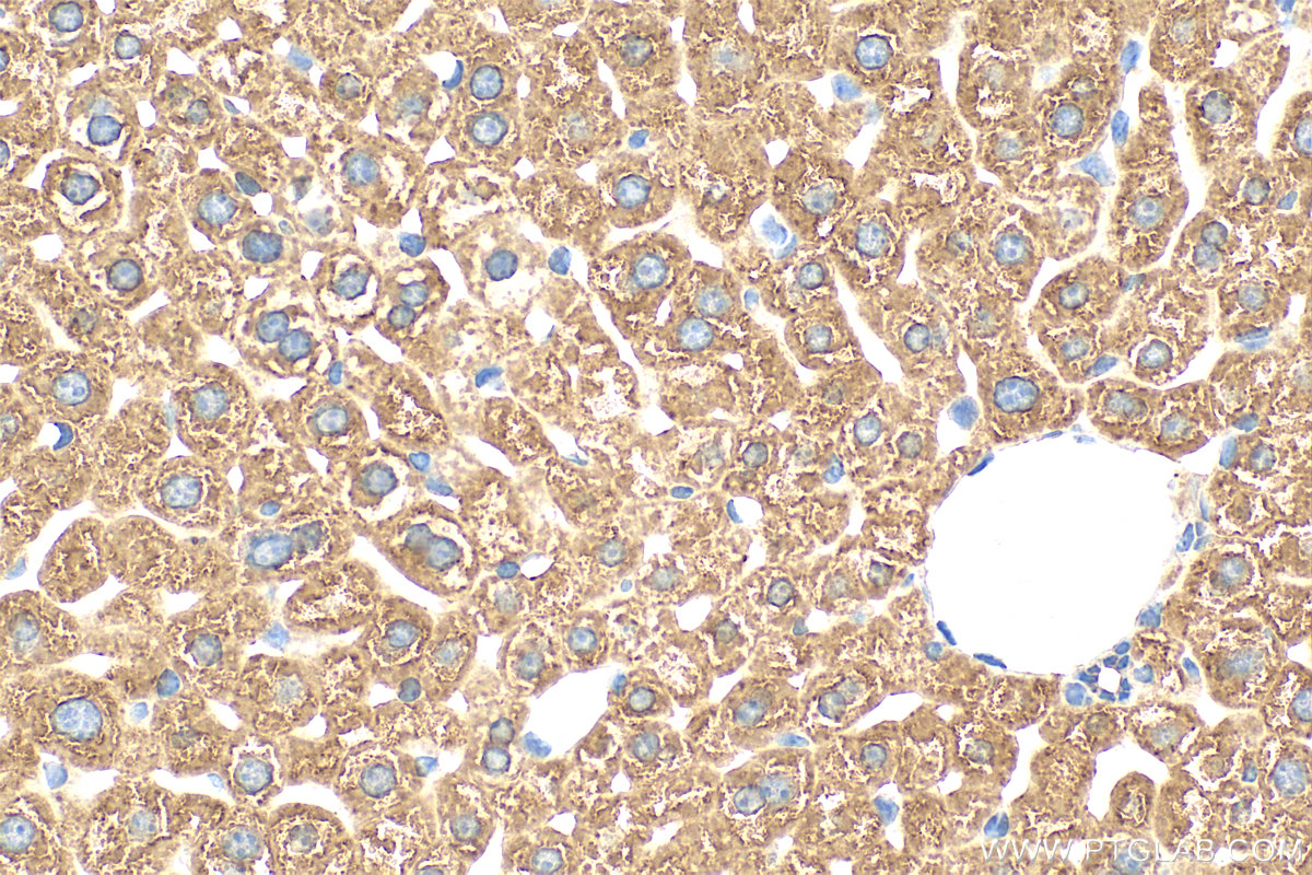 IHC staining of mouse liver using 29921-1-AP