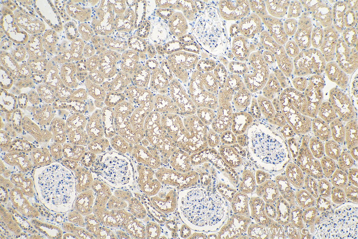 IHC staining of human kidney using 25070-1-AP