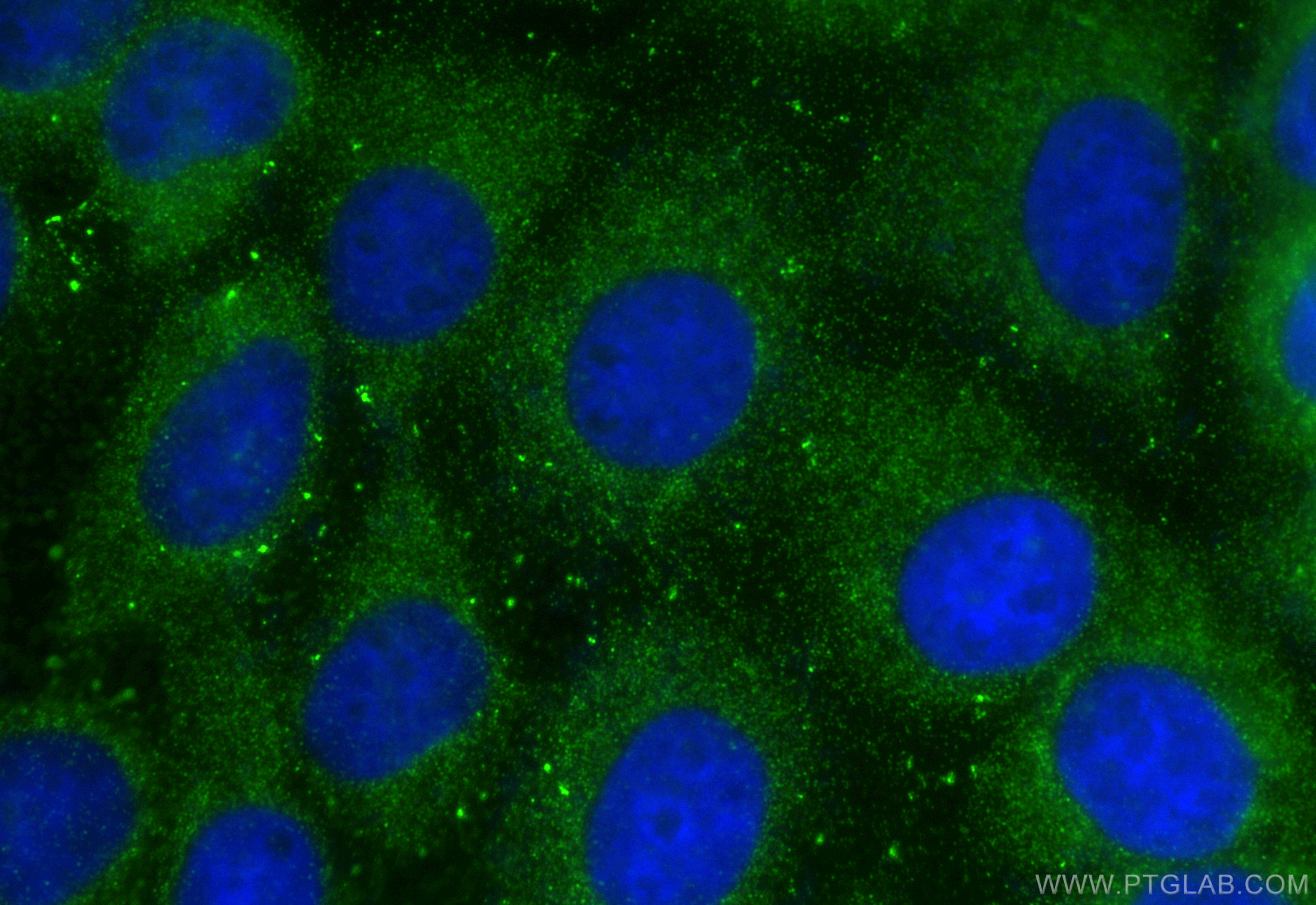 IF Staining of A431 using 21002-1-AP