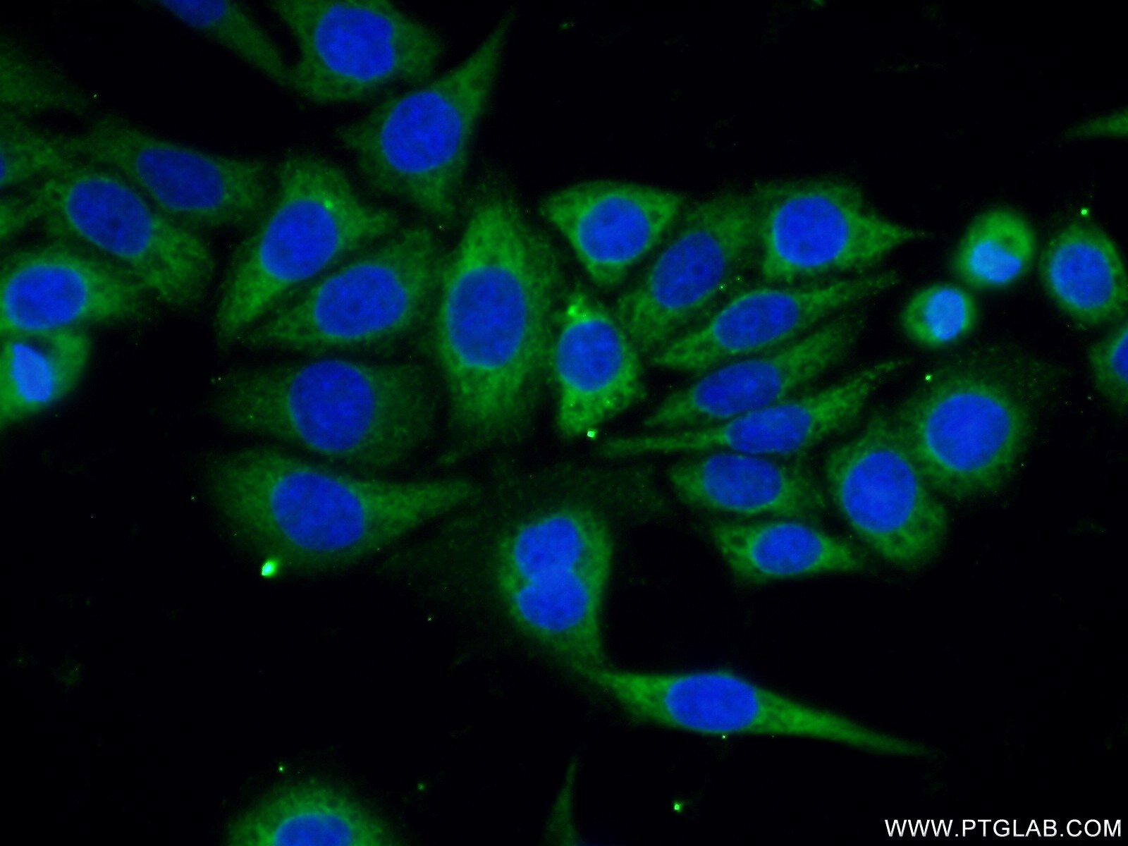 IF Staining of PC-3 using 25430-1-AP