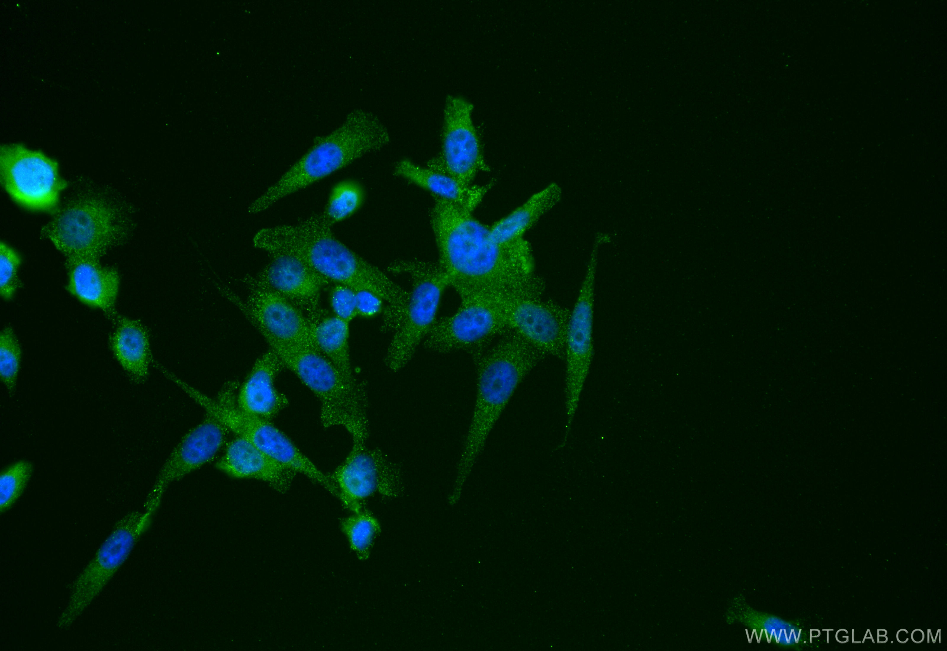 IF Staining of PC-3 using 68450-1-Ig (same clone as 68450-1-PBS)