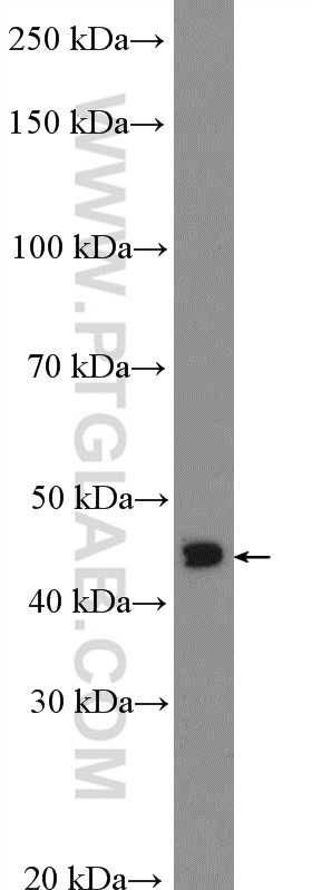 WB analysis of COLO 320 using 26595-1-AP