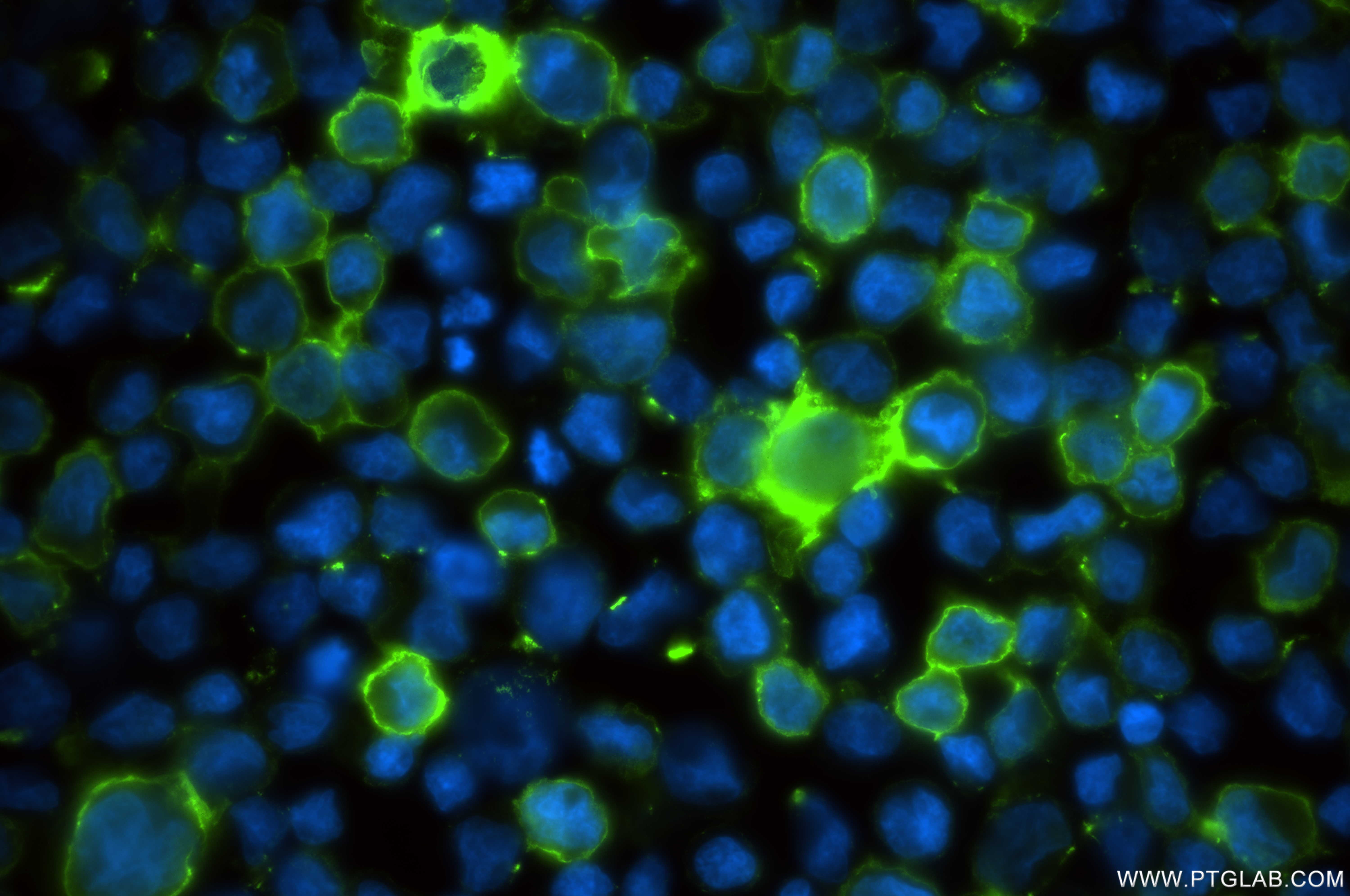 IF Staining of MJ using 82794-7-RR