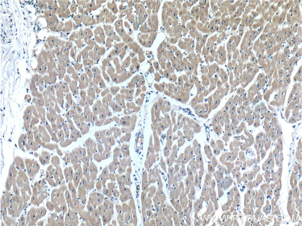 IHC staining of human heart using 16642-1-AP