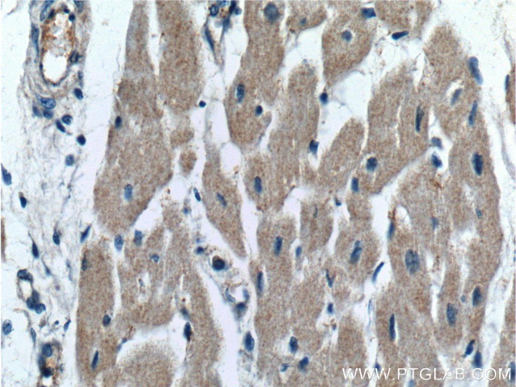 IHC staining of human heart using 16642-1-AP