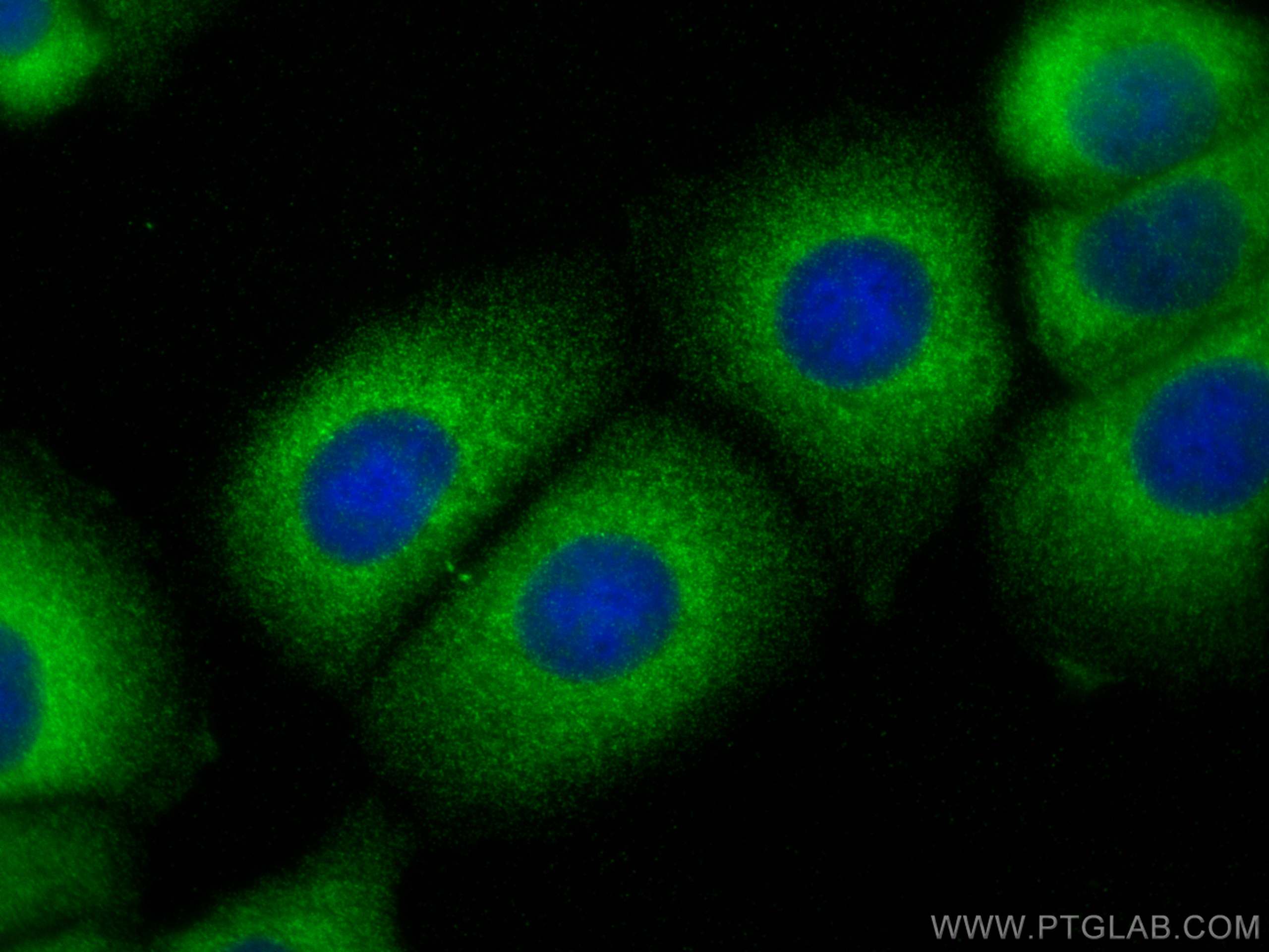 IF Staining of MCF-7 using 15611-1-AP