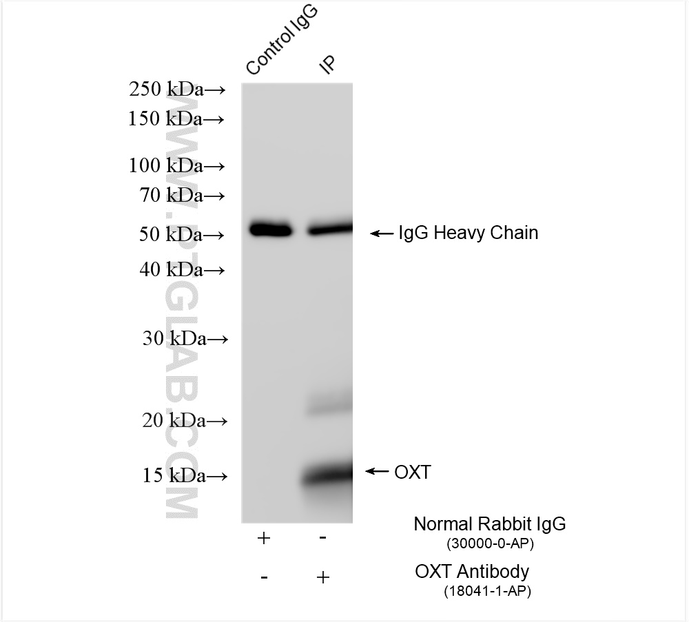 IP experiment of mouse pituitary gland using 18041-1-AP