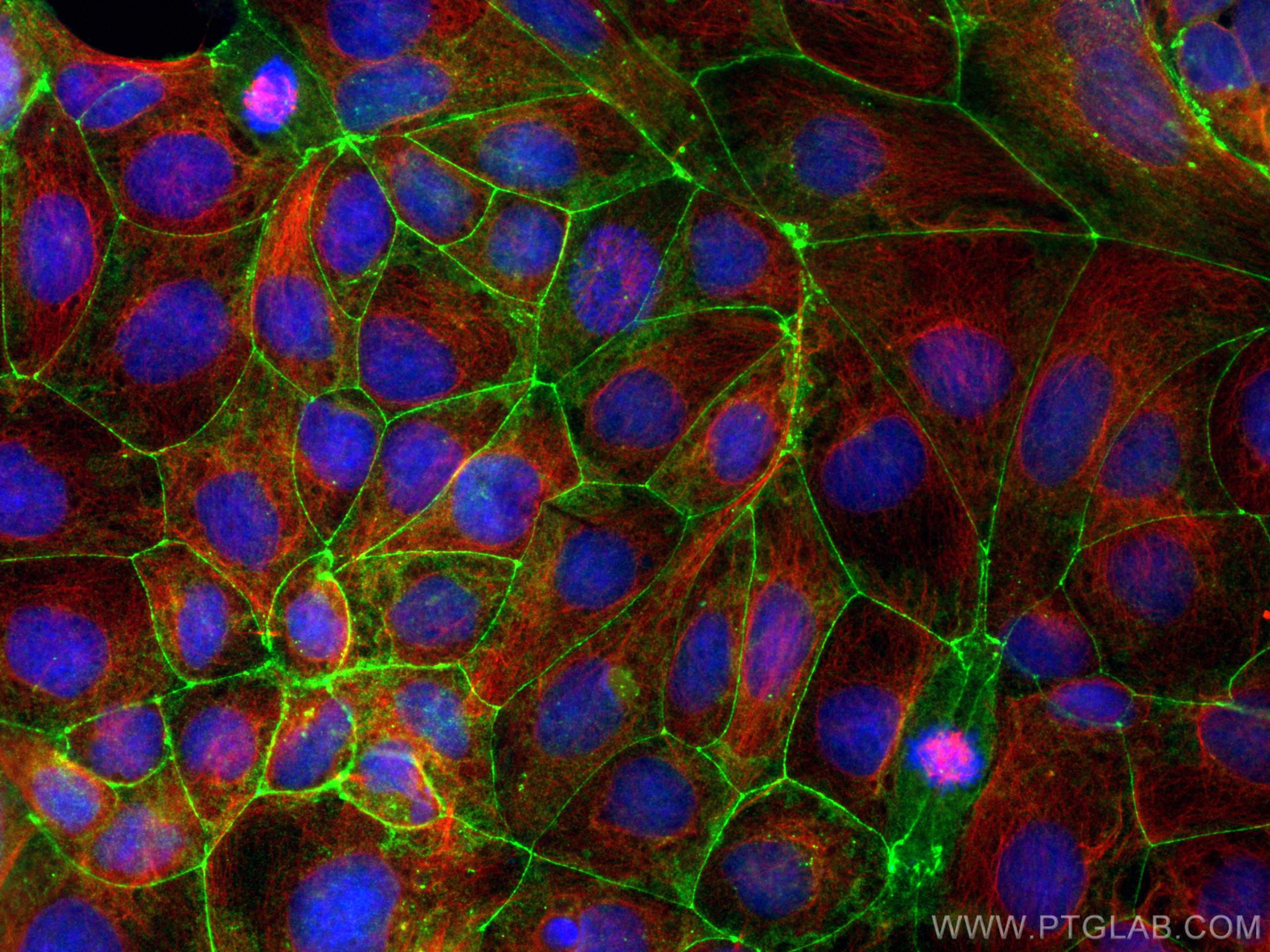 IF Staining of Caco-2 using 27260-1-AP