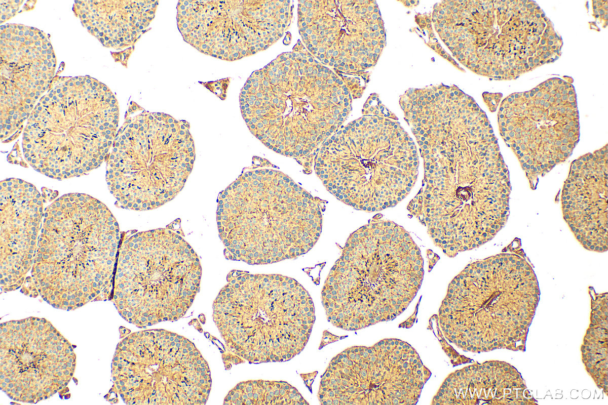 IHC staining of mouse testis using 23418-1-AP