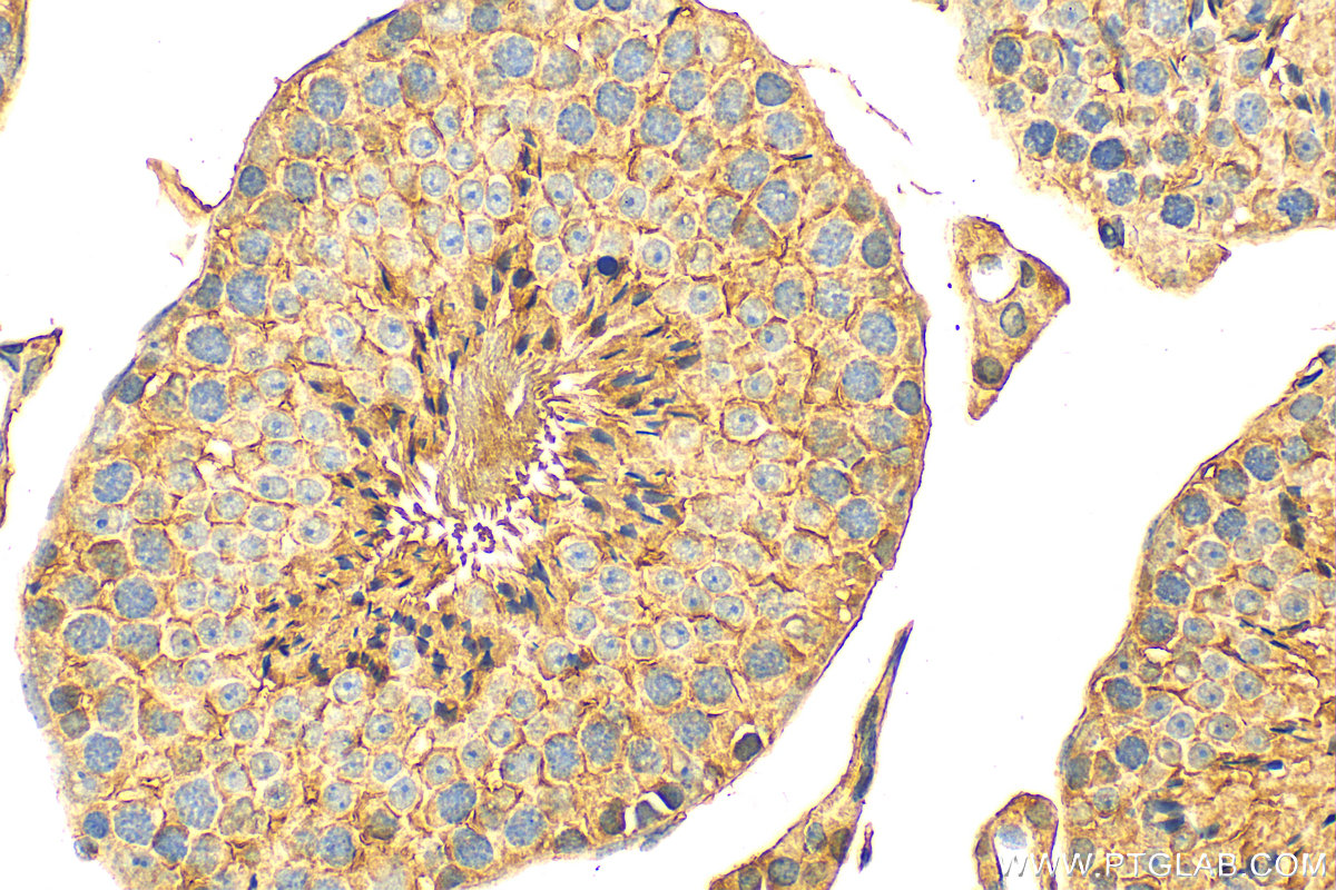 IHC staining of mouse testis using 23418-1-AP