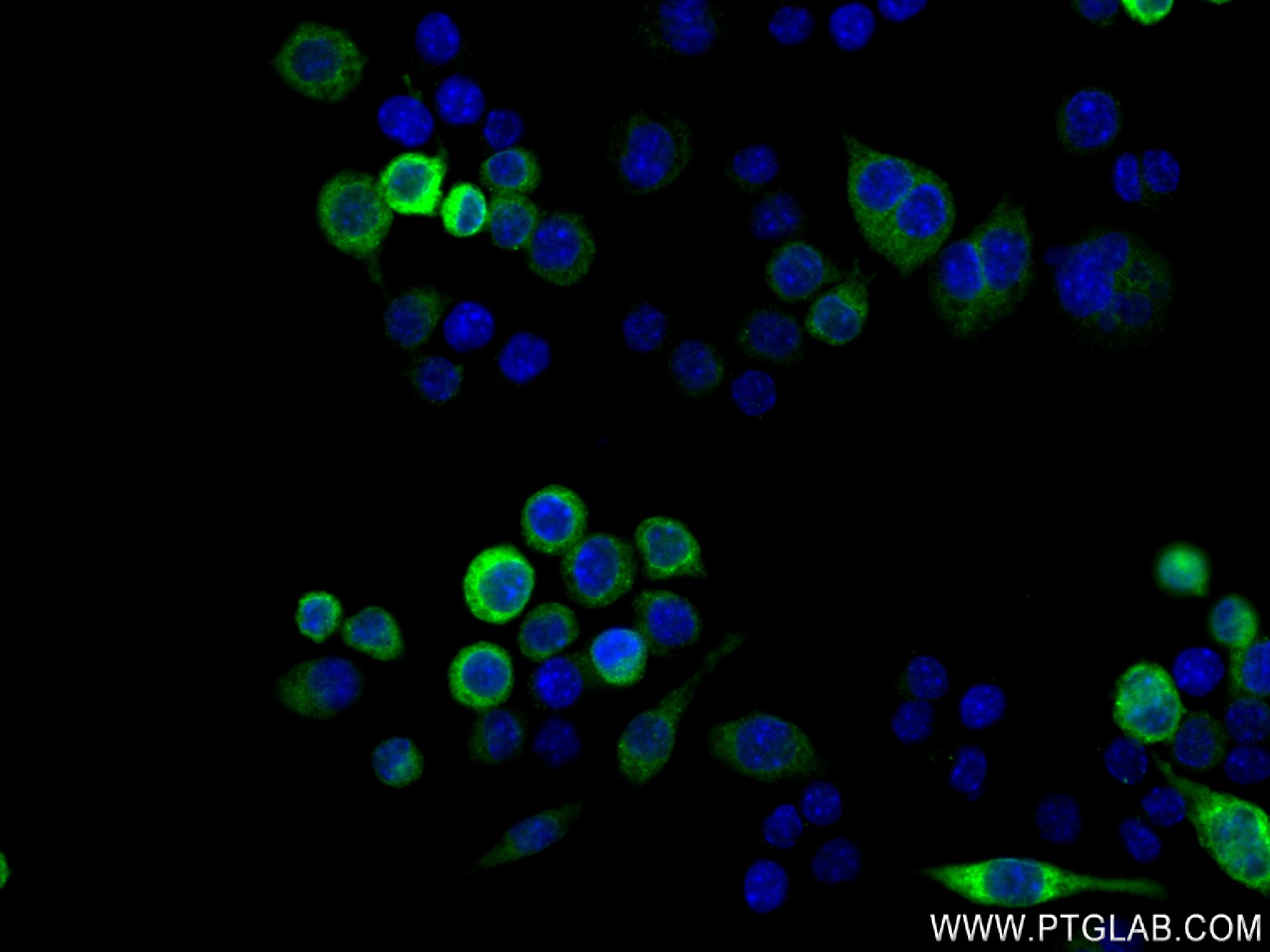 IF Staining of RAW 264.7 using 83413-6-RR (same clone as 83413-6-PBS)