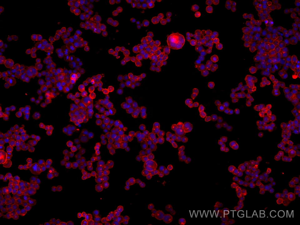 IF Staining of COLO 320 using 67258-2-Ig