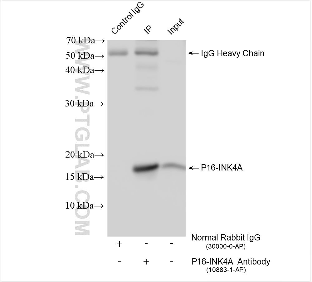 IP experiment of HEK-293 using 10883-1-AP