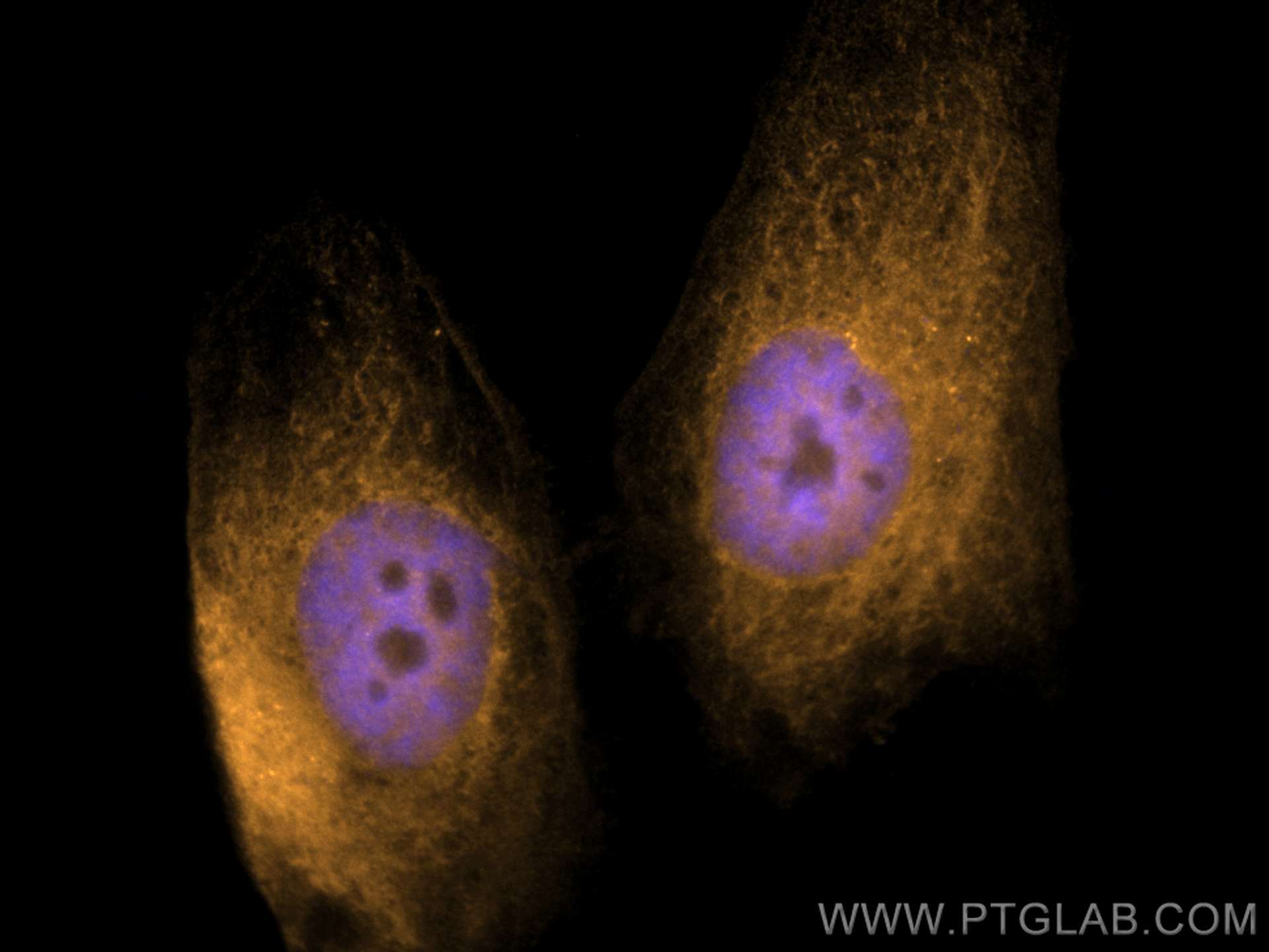 IF Staining of HeLa using CL555-10883