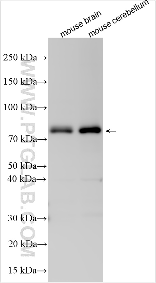 WB analysis using 11144-1-AP