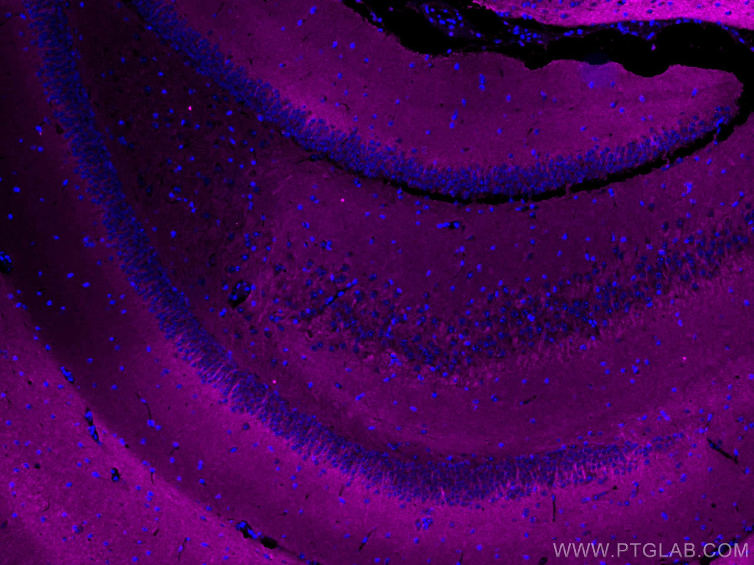 IF Staining of mouse brain using CL647-67654